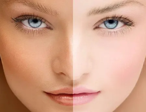 Skin Cancer a Threat in Winter as well as Summer