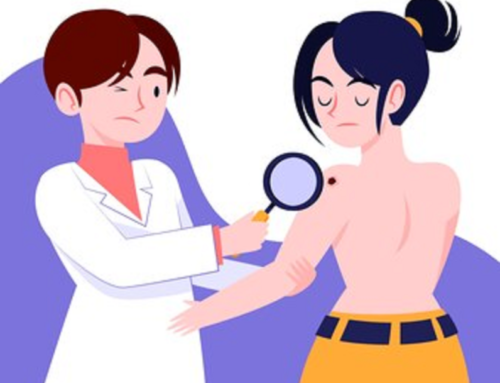 Skin Cancer